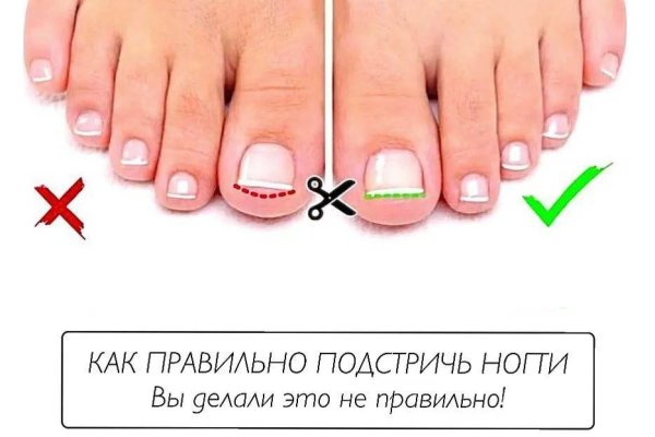 Замена гидры
